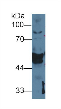 Polyclonal Antibody to Cytokeratin 14 (CK14)