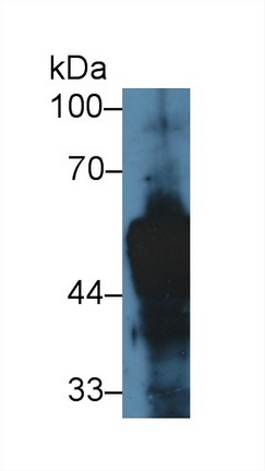 Polyclonal Antibody to Cytokeratin 14 (CK14)