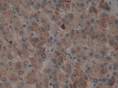 Polyclonal Antibody to Tissue Plasminogen Activator (tPA)