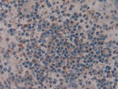 Polyclonal Antibody to Tissue Plasminogen Activator (tPA)