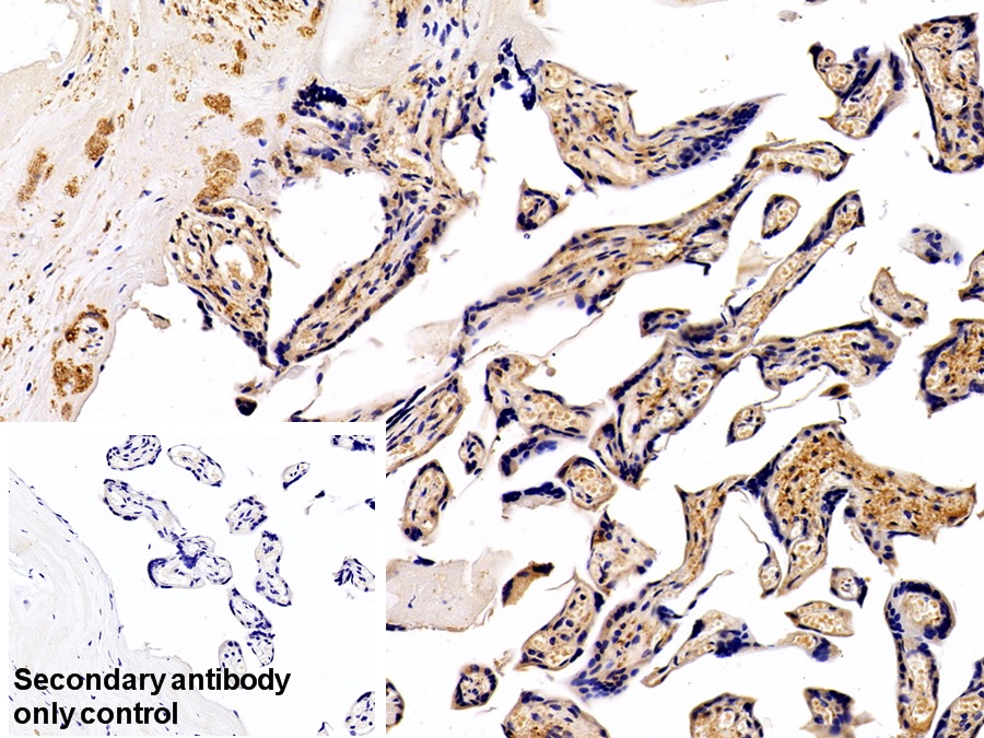 Polyclonal Antibody to Tissue Plasminogen Activator (tPA)