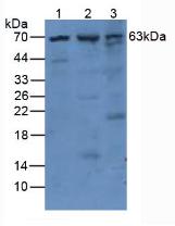 Polyclonal Antibody to Tissue Plasminogen Activator (tPA)