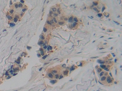 Polyclonal Antibody to Tissue Plasminogen Activator (tPA)