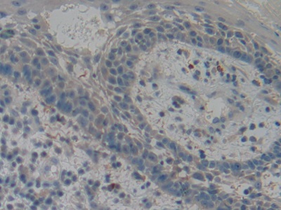 Polyclonal Antibody to Tissue Plasminogen Activator (tPA)