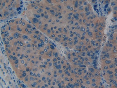 Polyclonal Antibody to Tissue Plasminogen Activator (tPA)