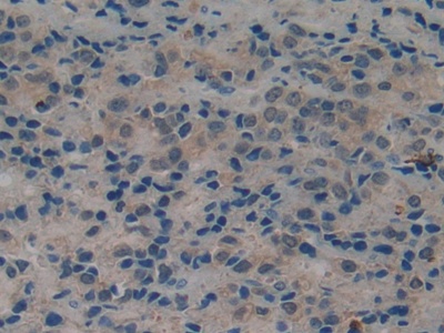 Polyclonal Antibody to Tissue Plasminogen Activator (tPA)