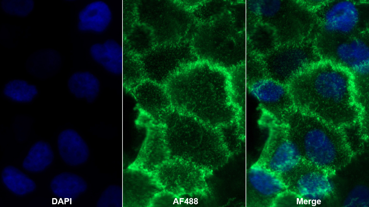 Polyclonal Antibody to Thrombomodulin (TM)