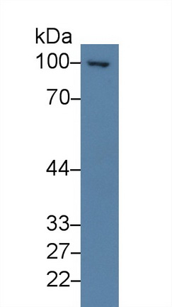 Polyclonal Antibody to Thrombomodulin (TM)