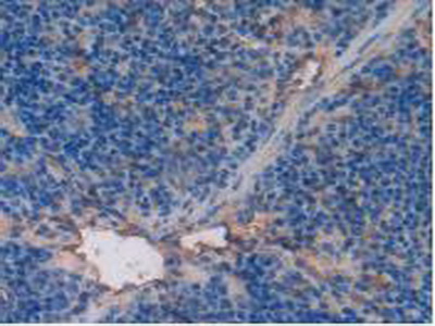 Polyclonal Antibody to Thrombomodulin (TM)