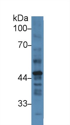 Polyclonal Antibody to Plasminogen Activator Inhibitor 2 (PAI2)