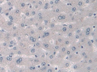 Polyclonal Antibody to Plasminogen Activator Inhibitor 1 (PAI1)