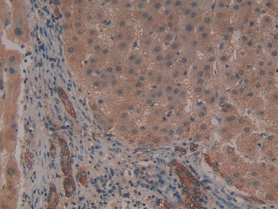 Polyclonal Antibody to Plasminogen Activator Inhibitor 1 (PAI1)