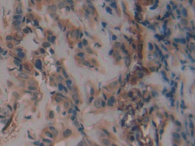 Polyclonal Antibody to Plasminogen Activator Inhibitor 1 (PAI1)