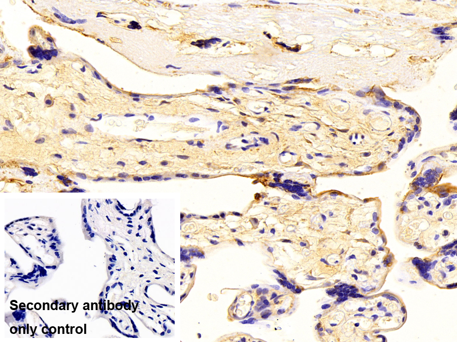 Polyclonal Antibody to Plasminogen Activator Inhibitor 1 (PAI1)