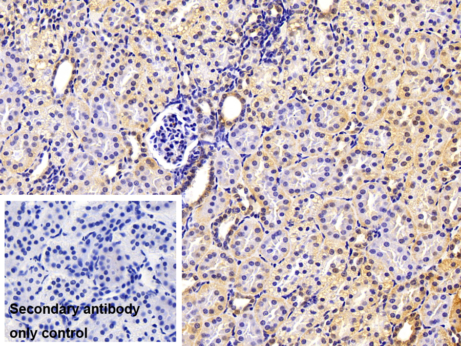 Polyclonal Antibody to Plasminogen Activator Inhibitor 1 (PAI1)