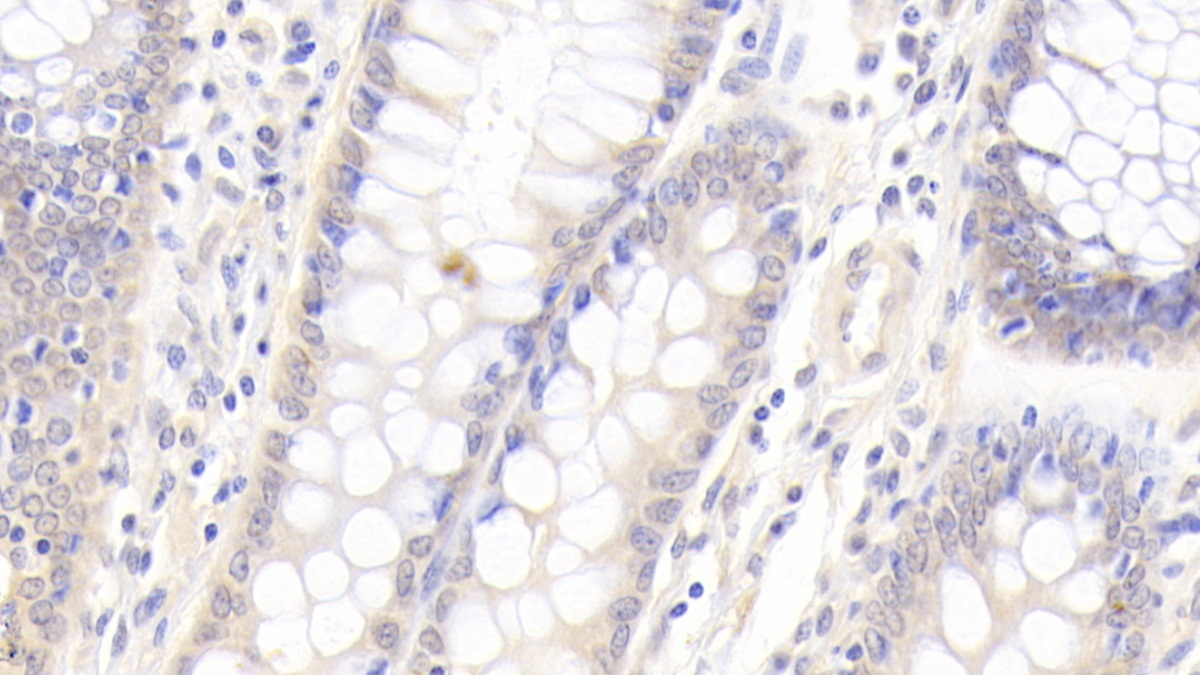 Polyclonal Antibody to Plasminogen Activator Inhibitor 1 (PAI1)