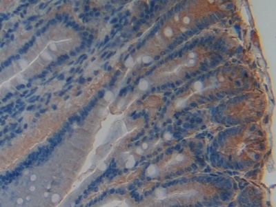 Polyclonal Antibody to Plasminogen Activator Inhibitor 1 (PAI1)