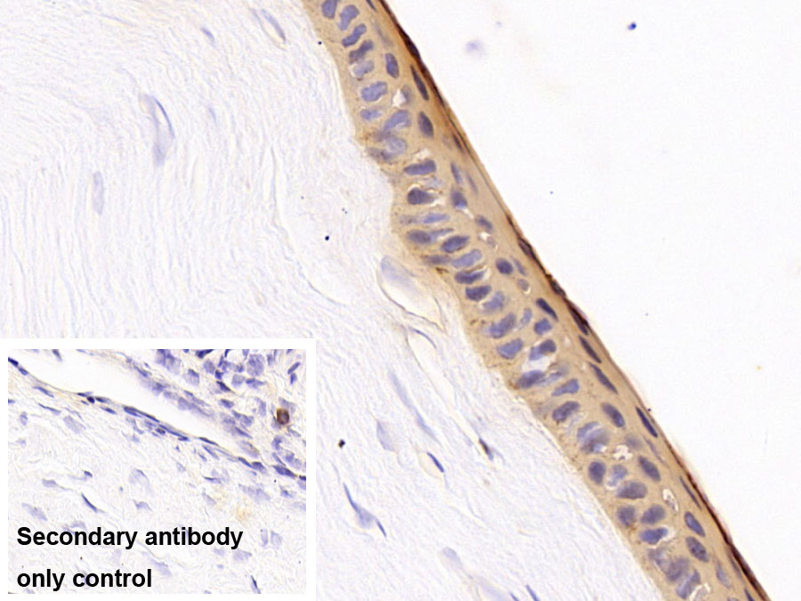 Polyclonal Antibody to Cytokeratin 12 (CK12)