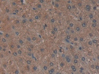 Polyclonal Antibody to Leucine Aminopeptidase (LAP)