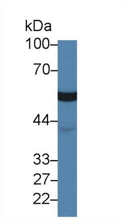 Polyclonal Antibody to Leucine Aminopeptidase (LAP)