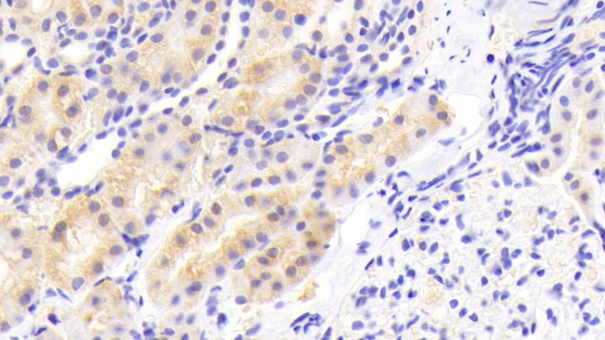 Polyclonal Antibody to Leucine Aminopeptidase (LAP)