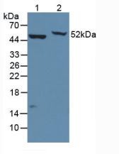 Polyclonal Antibody to Enolase, Neuron Specific (NSE)