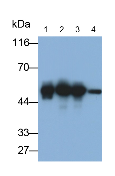 Polyclonal Antibody to Enolase, Neuron Specific (NSE)