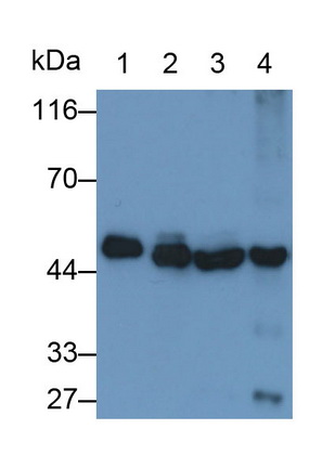 Polyclonal Antibody to Enolase, Neuron Specific (NSE)