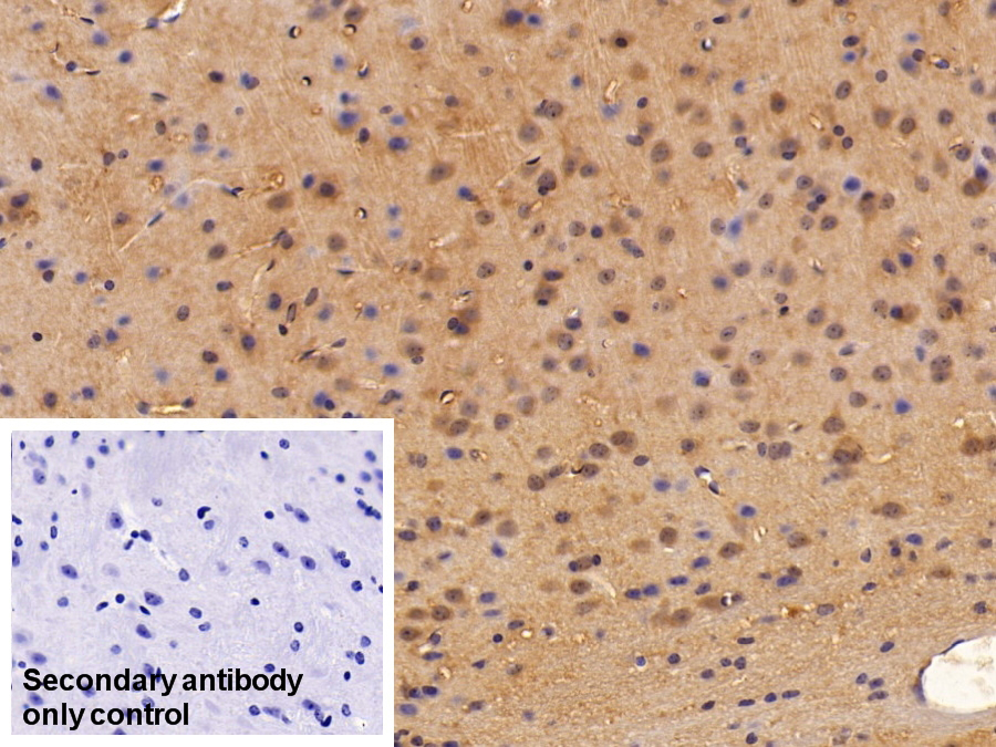 Polyclonal Antibody to Enolase, Neuron Specific (NSE)