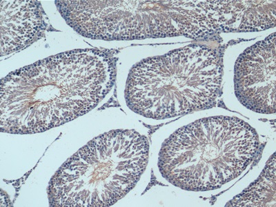 Polyclonal Antibody to Enolase, Neuron Specific (NSE)