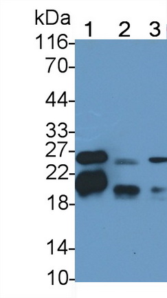 Polyclonal Antibody to Myelin Basic Protein (MBP)