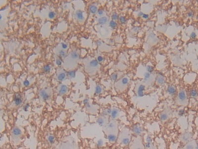 Polyclonal Antibody to Myelin Basic Protein (MBP)