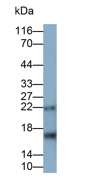 Polyclonal Antibody to Myelin Basic Protein (MBP)