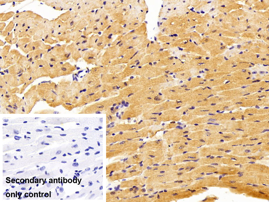 Polyclonal Antibody to Brain Natriuretic Peptide (BNP)