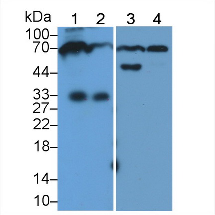 Polyclonal Antibody to Immunoglobulin M (IgM)