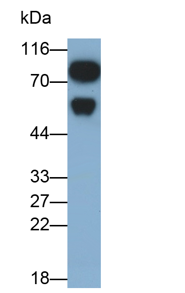 Polyclonal Antibody to Immunoglobulin M (IgM)