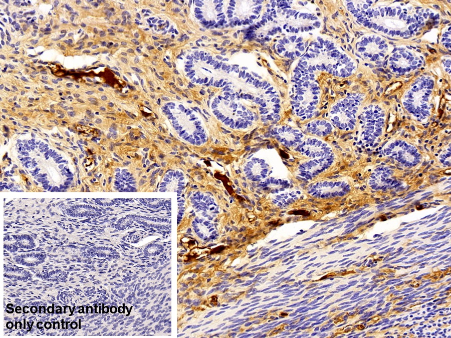 Polyclonal Antibody to Immunoglobulin G (IgG)