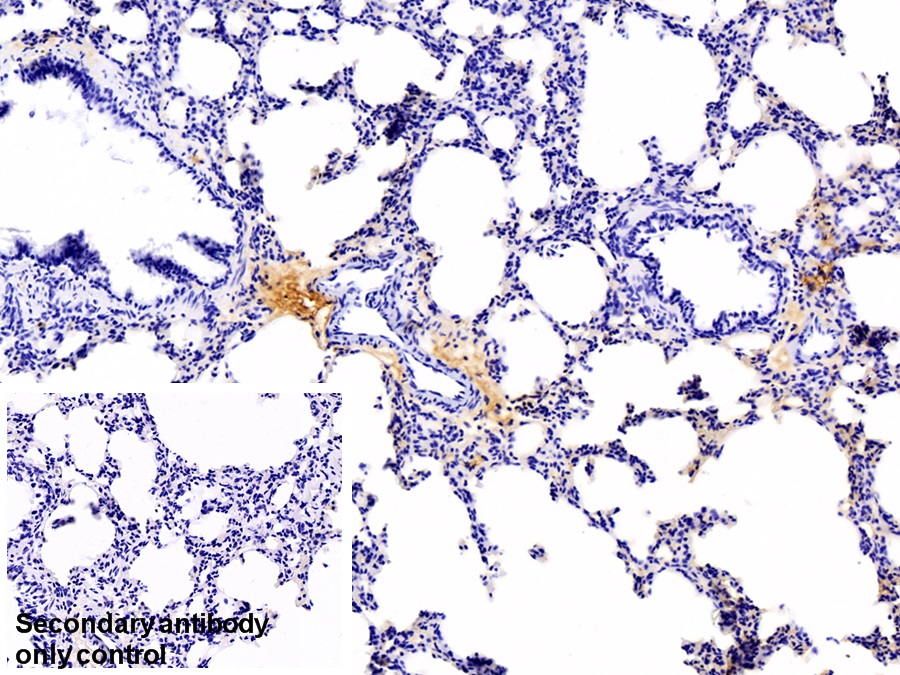 Polyclonal Antibody to Immunoglobulin G (IgG)