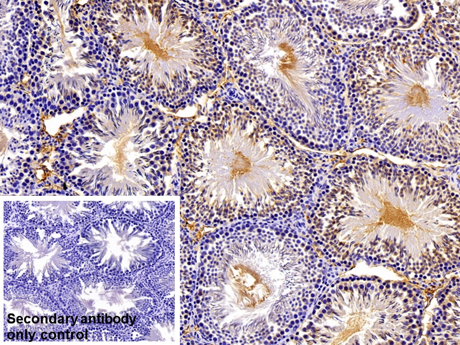 Polyclonal Antibody to Immunoglobulin G (IgG)