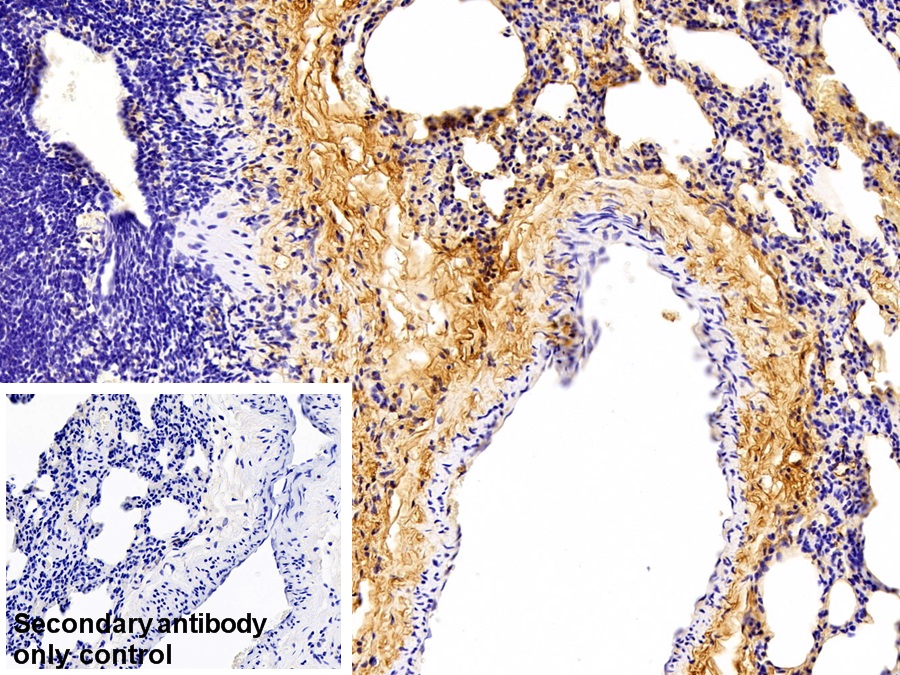 Polyclonal Antibody to Immunoglobulin G (IgG)