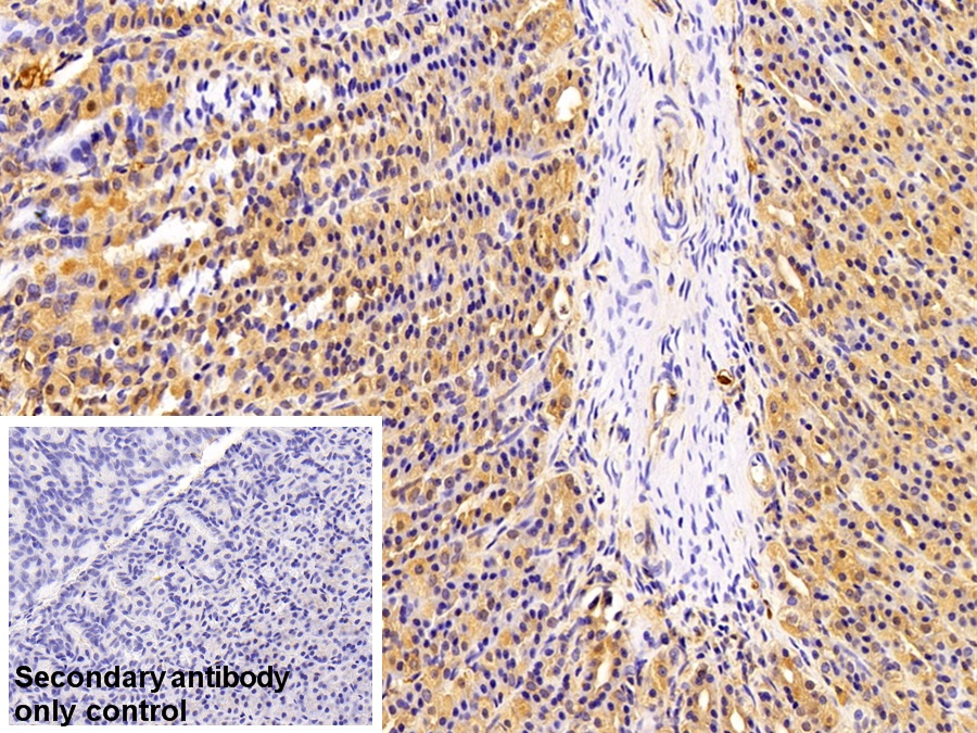 Polyclonal Antibody to Immunoglobulin G (IgG)