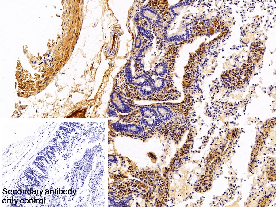 Polyclonal Antibody to Immunoglobulin G (IgG)