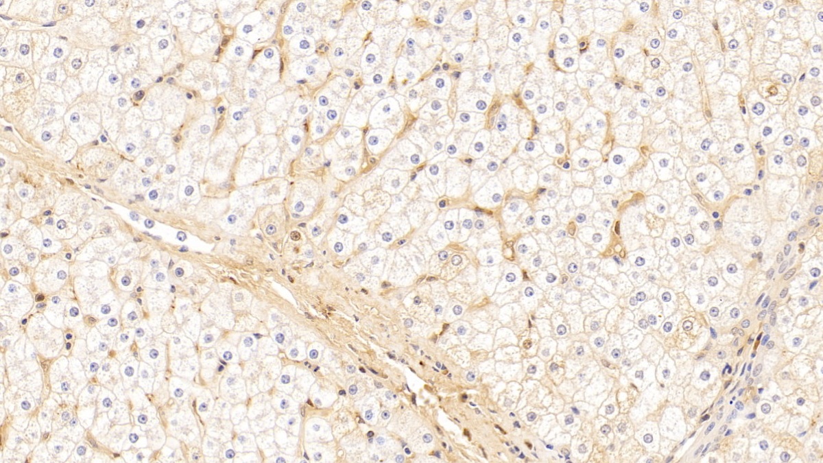 Polyclonal Antibody to Immunoglobulin A (IgA)