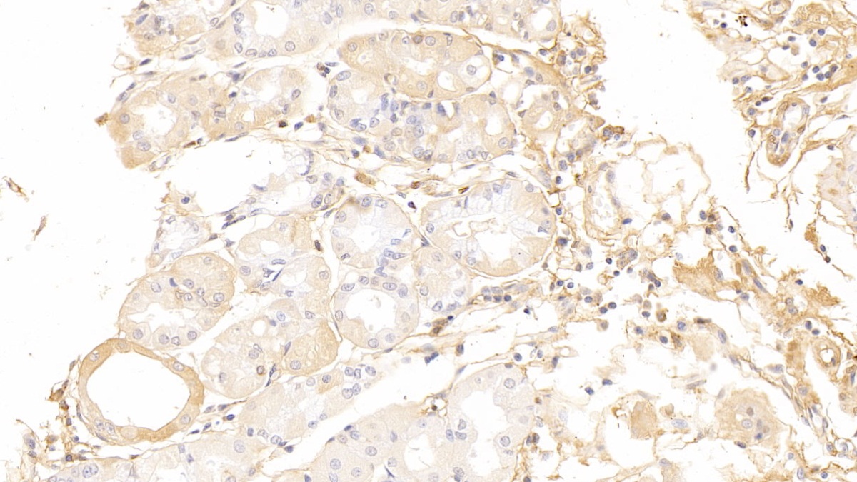 Polyclonal Antibody to Immunoglobulin A (IgA)