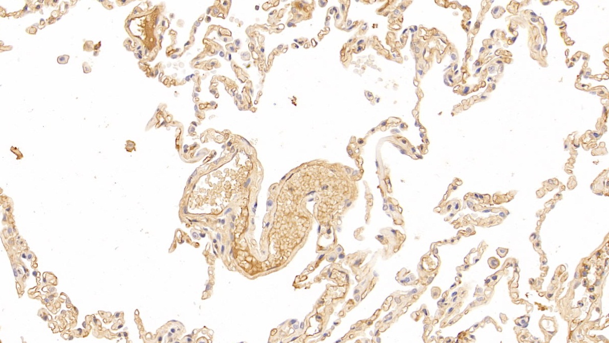 Polyclonal Antibody to Immunoglobulin A (IgA)