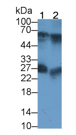 Polyclonal Antibody to Immunoglobulin A (IgA)