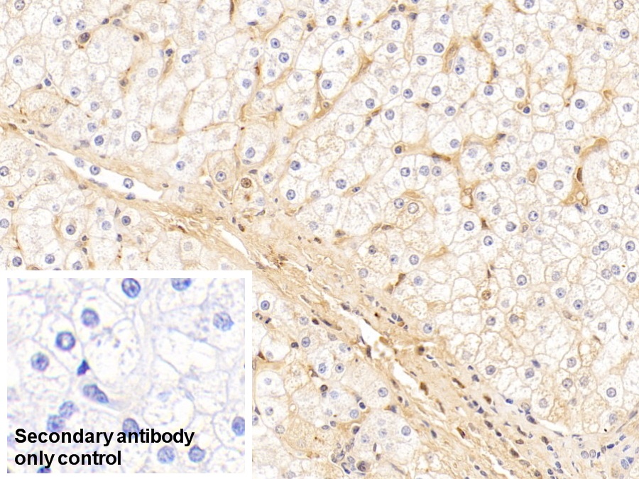 Polyclonal Antibody to Immunoglobulin A (IgA)