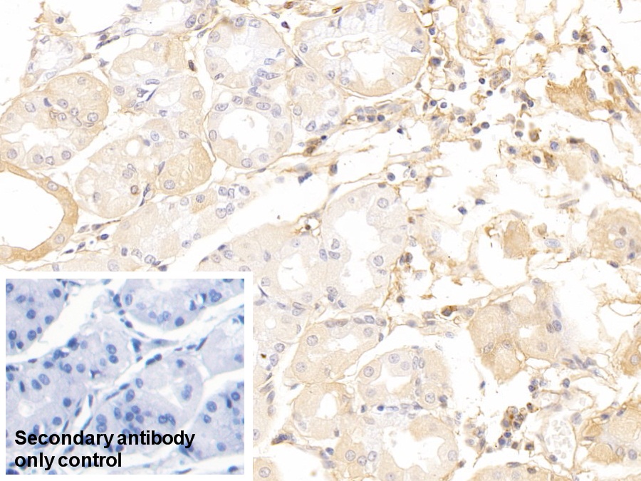 Polyclonal Antibody to Immunoglobulin A (IgA)