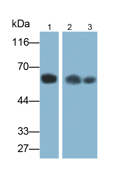 Polyclonal Antibody to Immunoglobulin A (IgA)