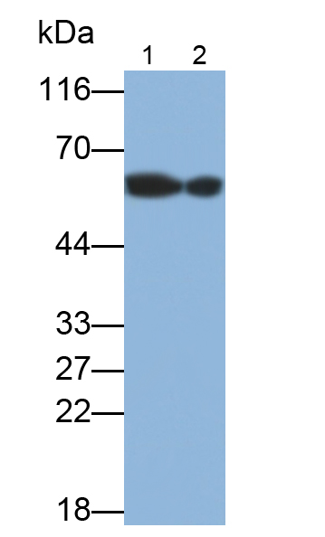 Polyclonal Antibody to Immunoglobulin A (IgA)